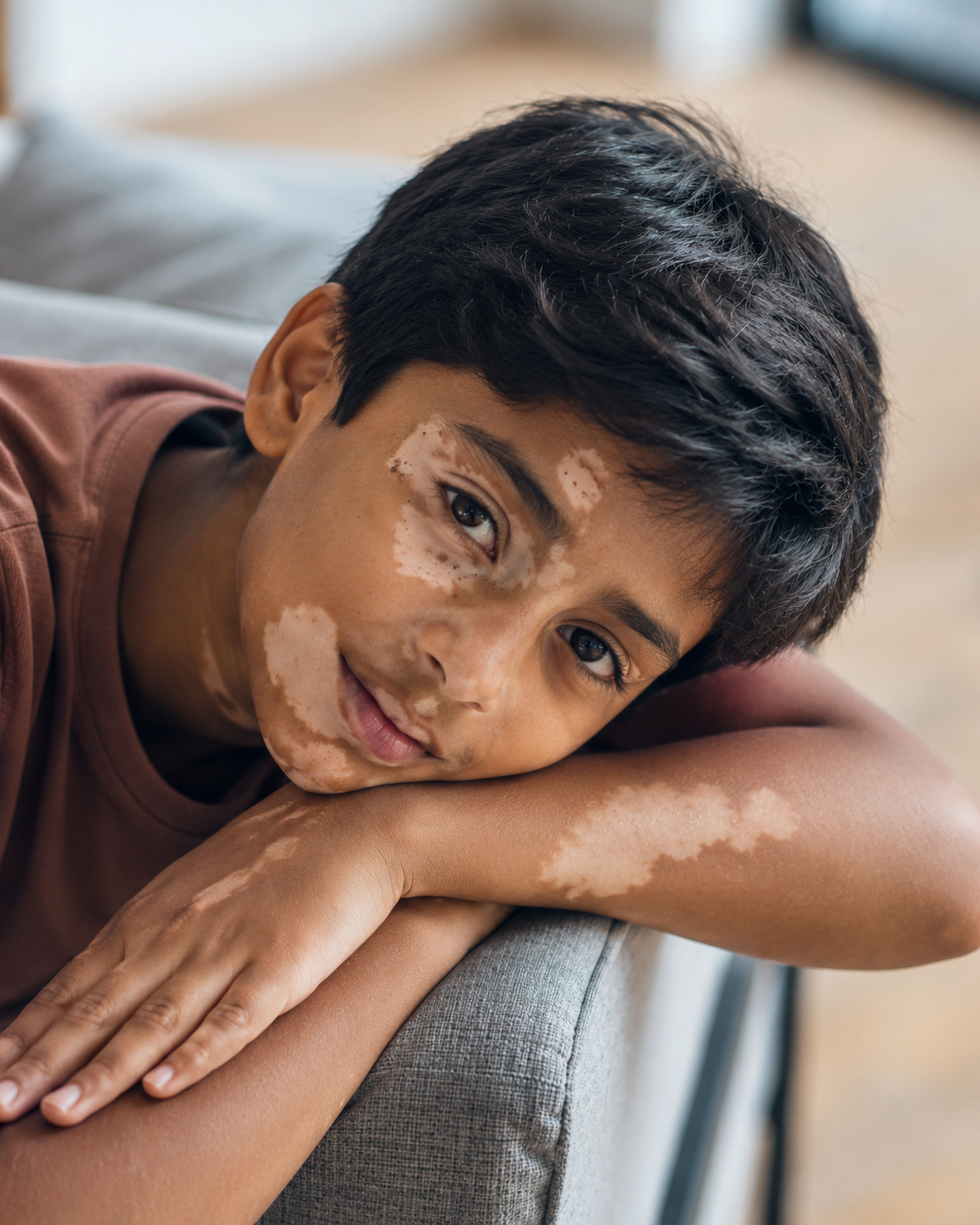 Vitiligo care consultation